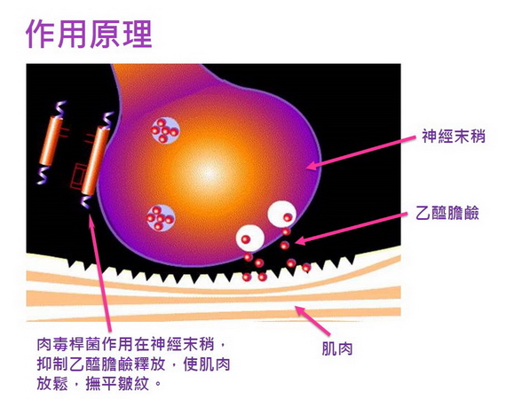 肉毒桿菌作用原理