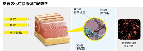 老化皮膚的膠原蛋白流失