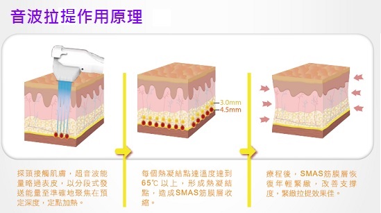 音波拉提原理