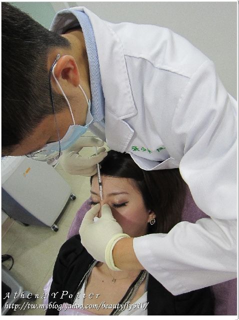 微晶瓷隆鼻過程04