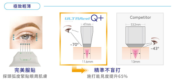 精準度提高的Q+立線音波