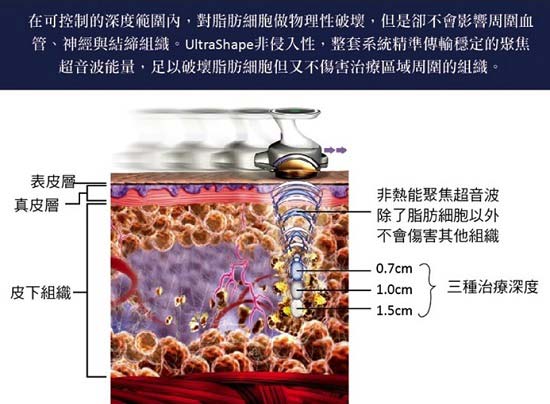 標靶震波溶脂原理