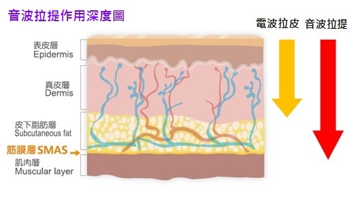 音波拉皮作用深層