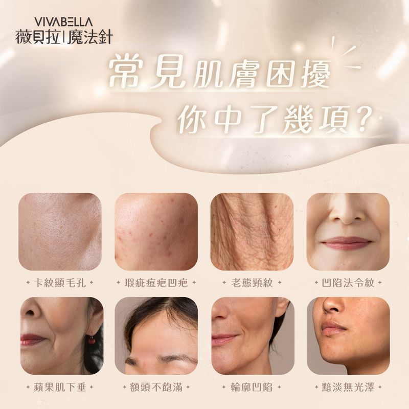 薇貝拉改善部位
