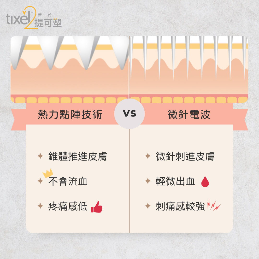 熱力點陣技術vs微針電波比較