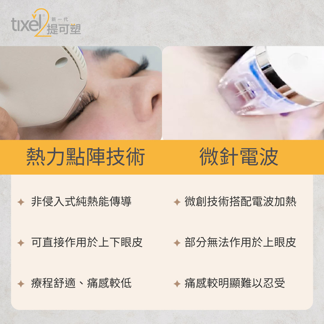熱力點陣技術vs微針電波差異